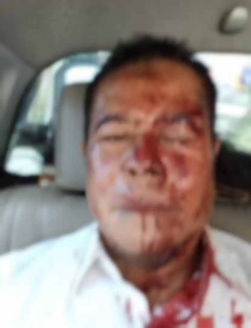 Jemput Jenazah Berujung Ricuh hingga 25 Ruko Dibakar2