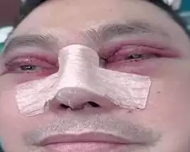 Kejagung Ciduk Aleg NasDem Ujang Iskandar5