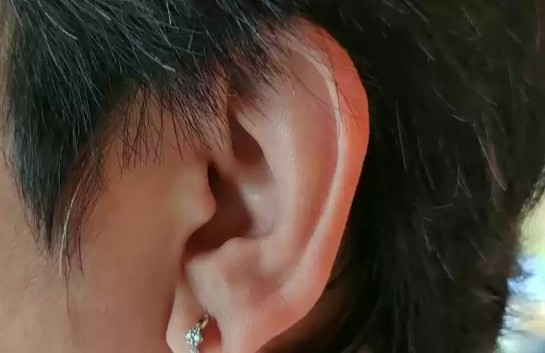 Ilustrasi - Tinnitus atau telinga berdenging. (Foto: Antara)