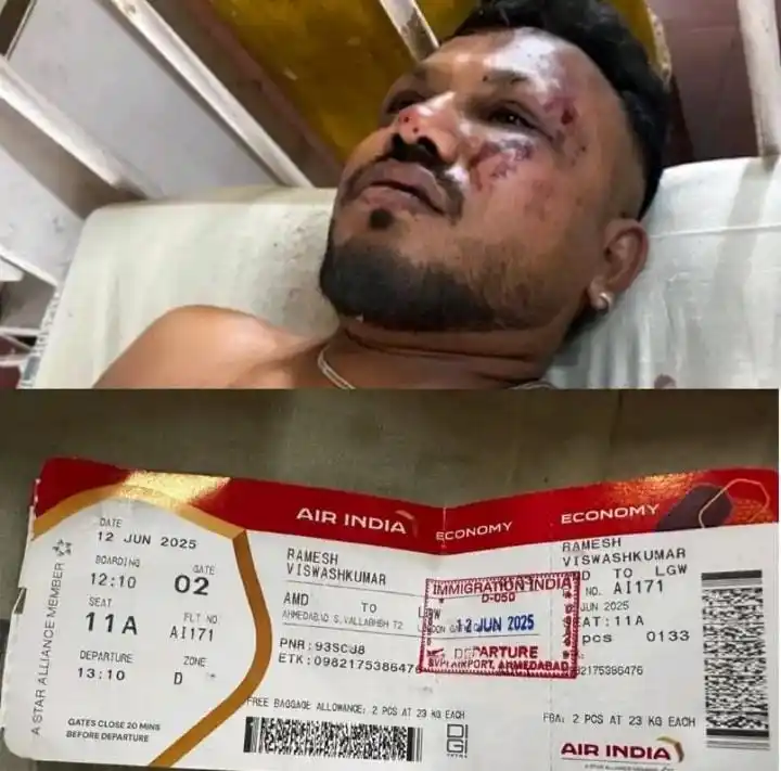 Ramesh, Saut-satunya Penumpang yang Selamat dari Kecelakaan Air India (Foto: Repro)